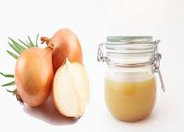 علاج قشرة الشعر نهائيًا