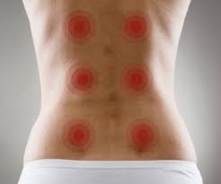 نقاط العلاج بالضغط  في الجسم لتجديد النشاط