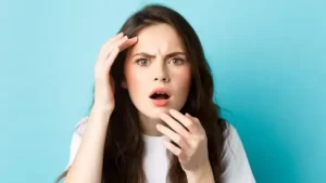 أسباب قشرة الحواجب وعلاجها