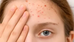 طريقة تزييت الشعر