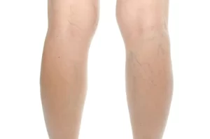 التغيرات النفسية والجسدية للحامل وحلها