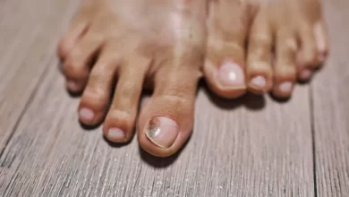 أسباب سواد أظافر القدم
