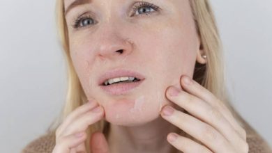 أسباب جفاف البشرة