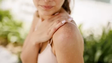 أسباب تقشر جلد البشرة