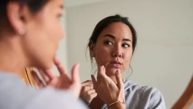 أسباب ظهور البقع البيضاء على الجلد