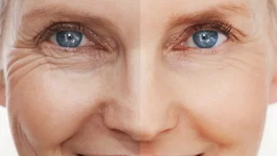 الفيبروبلاست لشد الجلد بدون جراحة