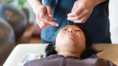 الوخز بالإبر الصينية لعلاج الصداع النصفي