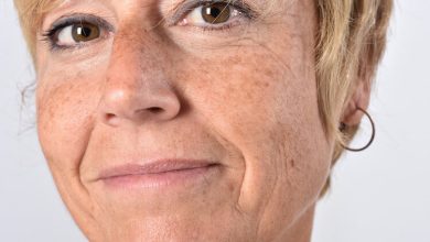 كيف اتخلص من بقع الشيخوخة في أسرع وقت